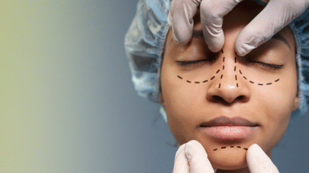 rhinoplasty